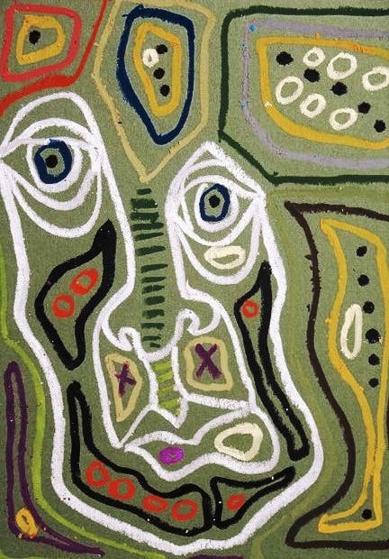 295.20 Schizophrenia, Catatonic Type