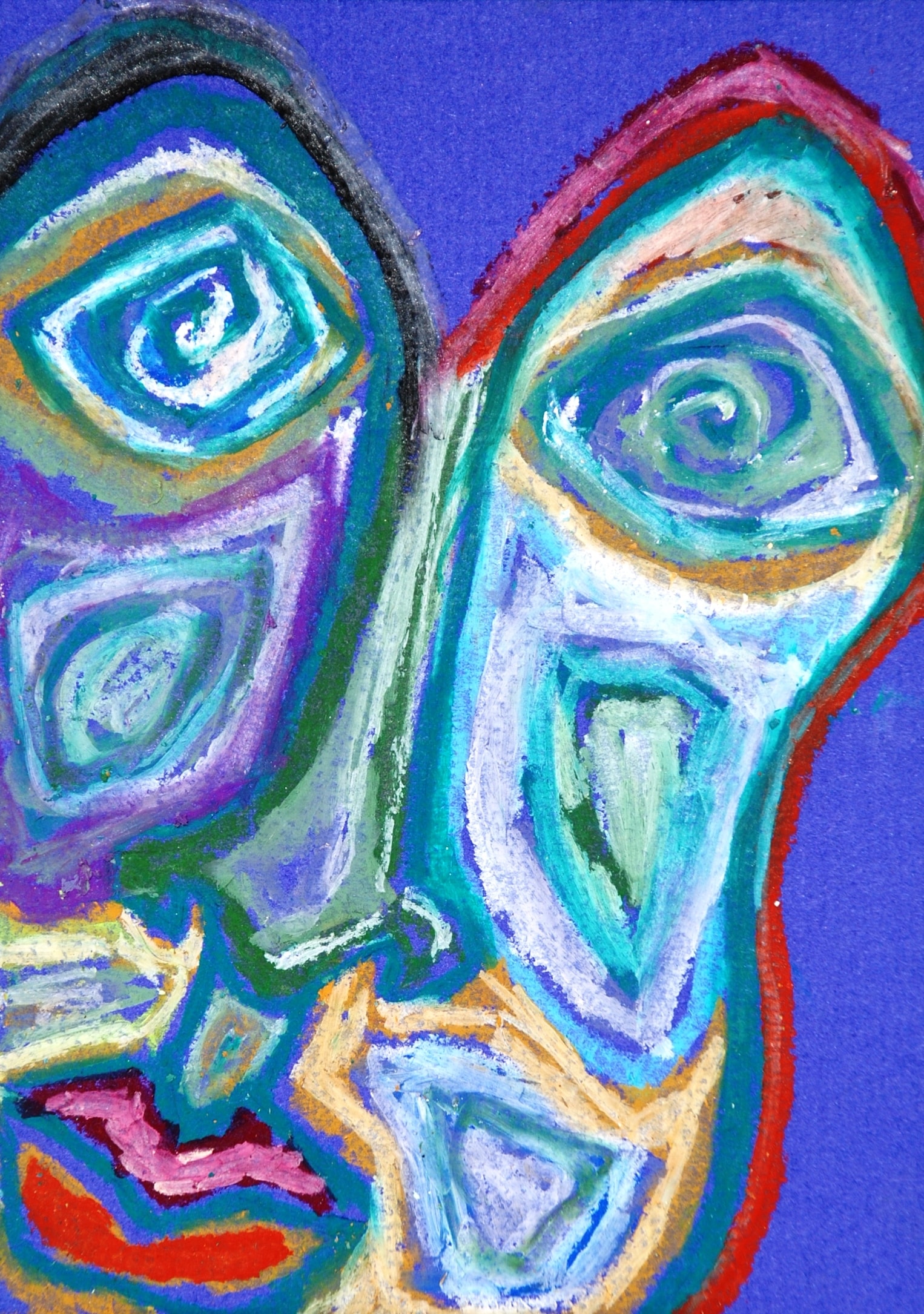 295.30B Paranoid Schizophrenia