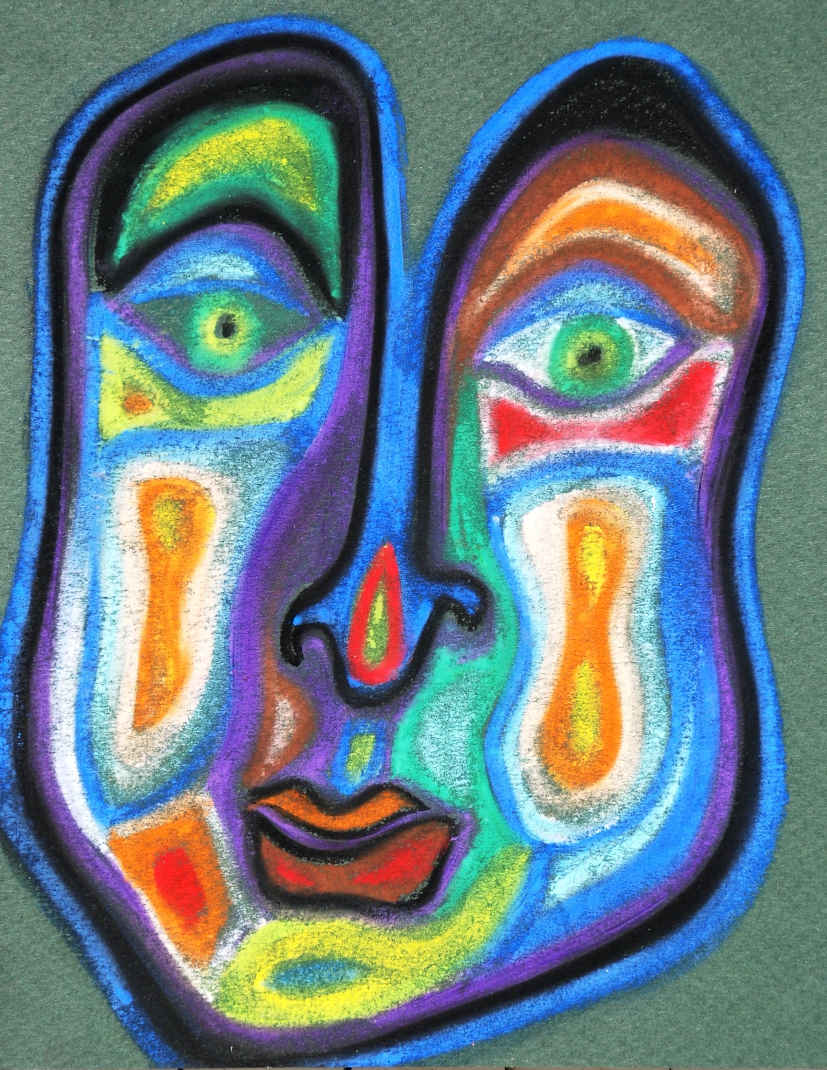 295.90 Schizophrenia, Undifferentiated Type