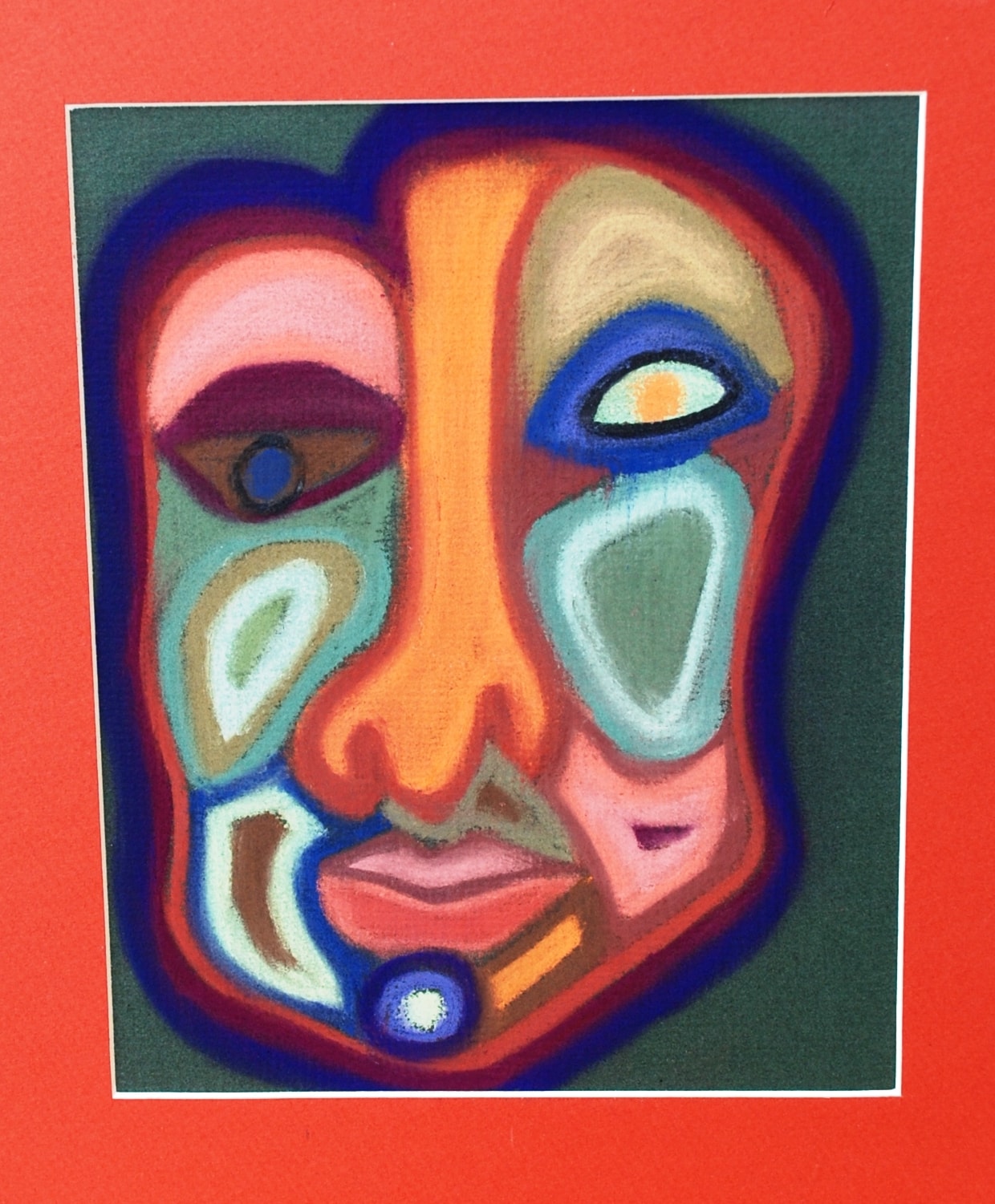 296.4xA Bipolar I Disorder, Most Recent Episode Manic
