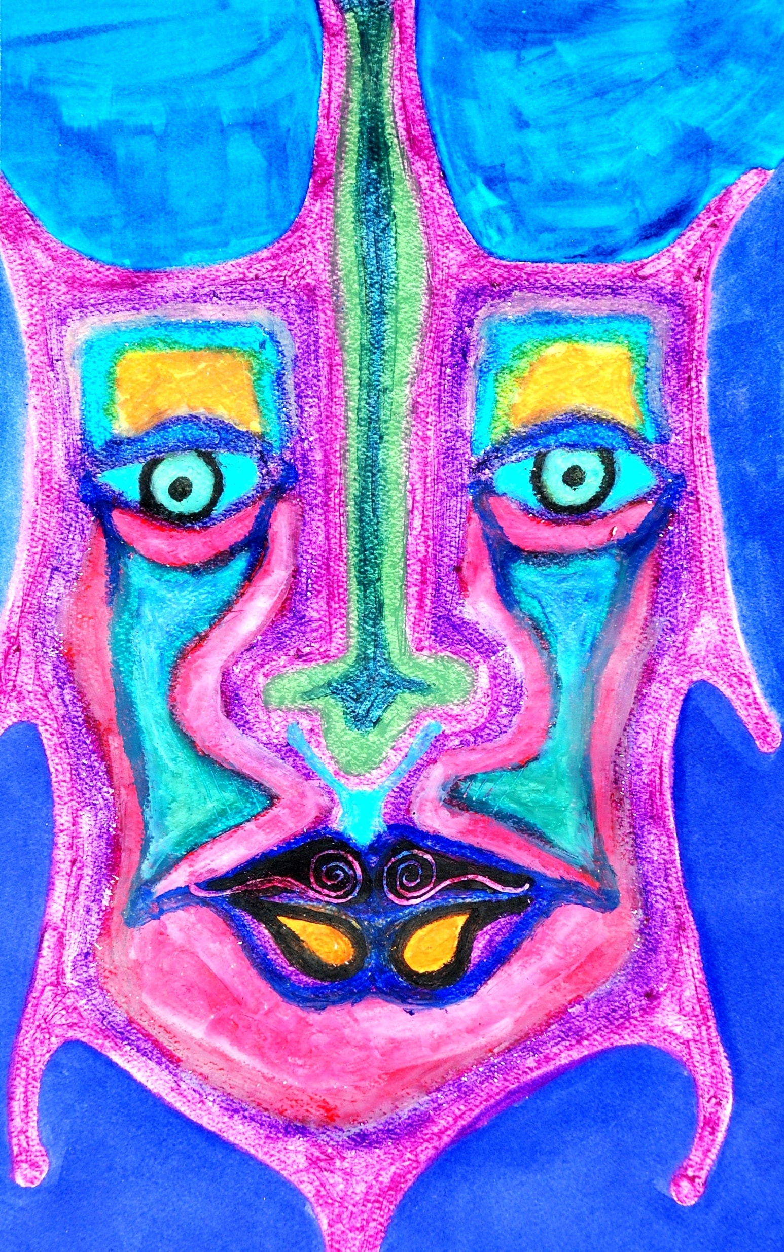 296.4xD Bipolar I Disorder, Most Recent Episode Manic